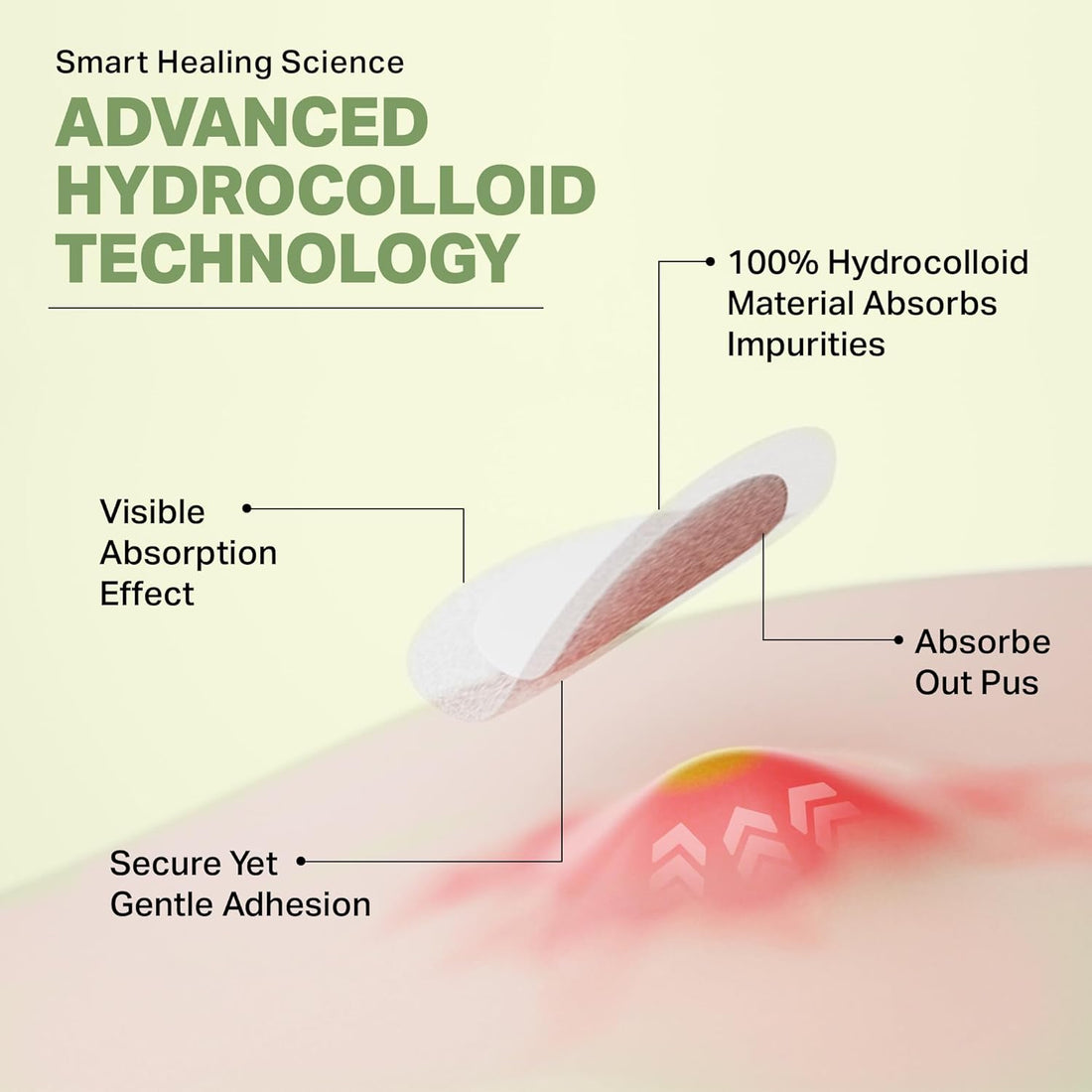 L'HIRONDELLE Hydrocolloid Spot Dot Pimple Patches for Face, 144 Invisible Skin Patches for Zits and Blemishes, Clear Acne Dots Stickers for Day and Night Absorbing Patch for Oily Skin 2 Sizes 9, 12mm